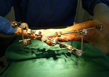 Operation du talon d'achille chez un chien - Clinique veterinaire du Vernet
