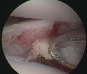 Arthroscopie du coude d’un Bouvier Bernois de 8 mois - Clinique du Vernet