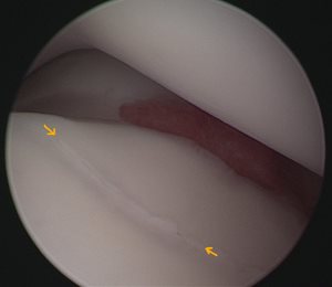 Arthroscopie du coude d’un Bouvier Bernois de 8 mois - Clinique du Vernet