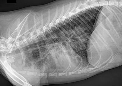 Bronchopneumonie / Imagerie - Clinique du Vernet
